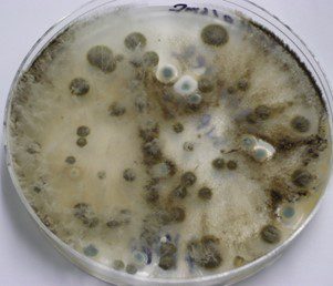 Are you experiencing brain fog?  It could it be from exposure to Mycotoxins generated by mold?